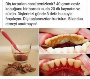 Kendinle İlgilen- ceviz diş tartarları