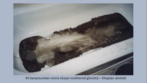 Bentonit Kil Banyosu sonrası